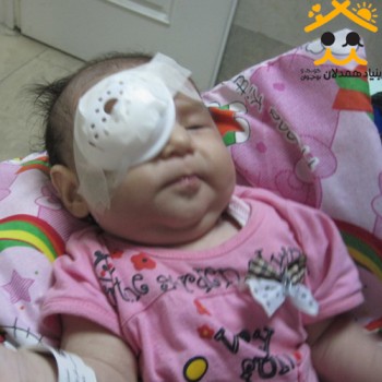 گزارش جراحی چشم غزل