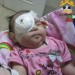 گزارش جراحی چشم غزل